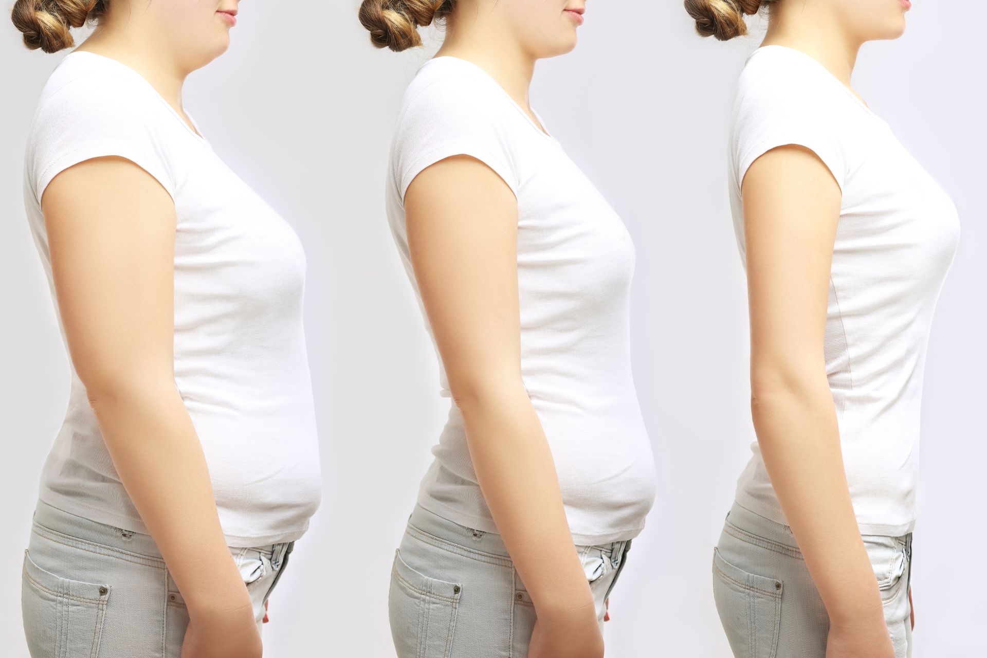 Three side-by-side profiles of the same woman in a white t-shirt and jeans illustrate her journey with weight loss services, showcasing remarkable transformations in body shape.
